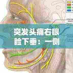 突发头痛右眼睑下垂:一侧头痛伴随眼睑下垂